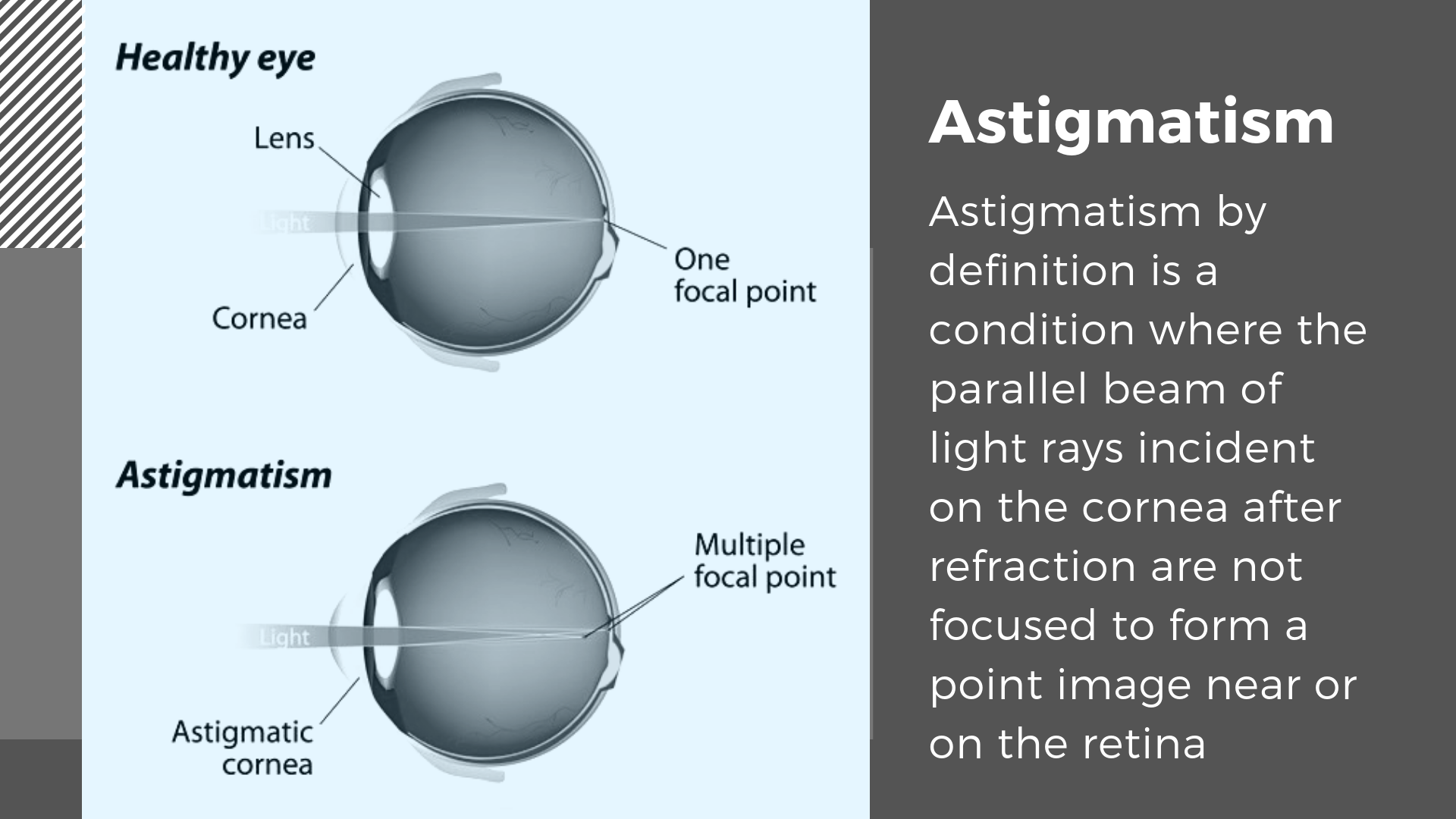 Children’s Eye Diseases