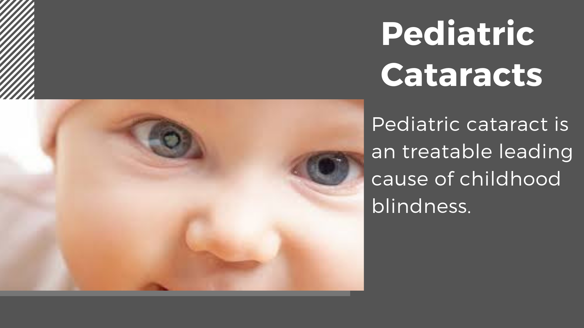 Children's Eye Diseases most commonly seen | Eyemantra