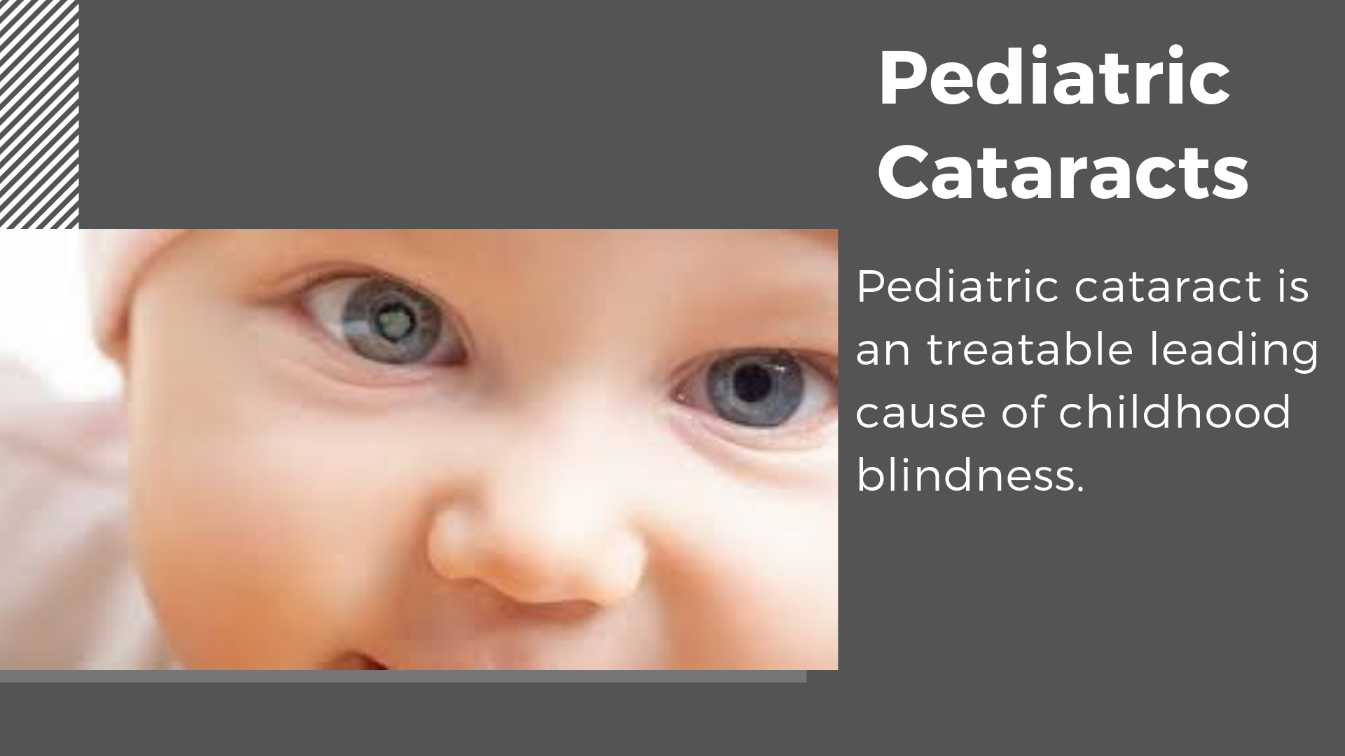 Children’s Eye Diseases