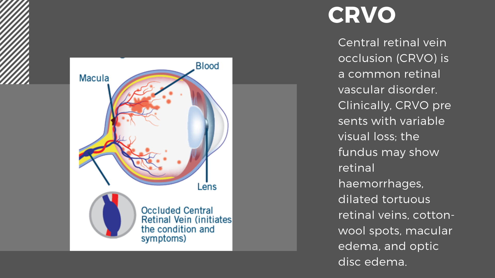 Children’s Eye Diseases