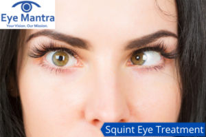Squint Eye Treatment
