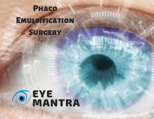 Phaco-Emulsification surgery