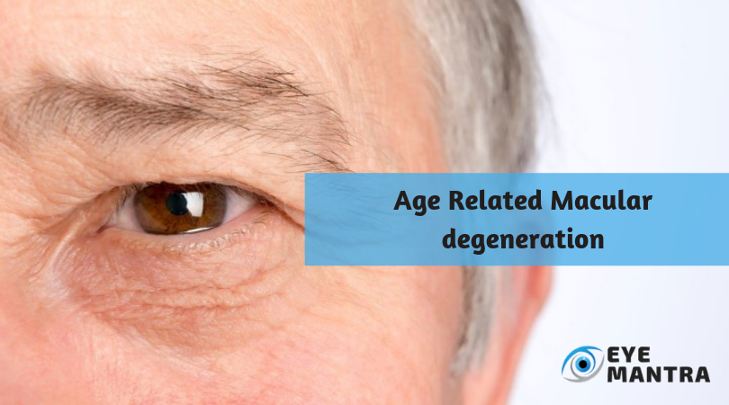 macular-degeneration-amd-causes-and-treatment-eyemantra