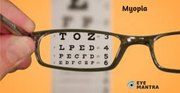 Myopia | Eye Mantra