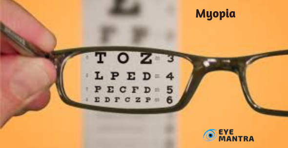 Myopia