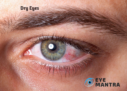 Eye diseases