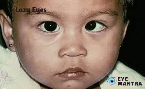 Eye diseases