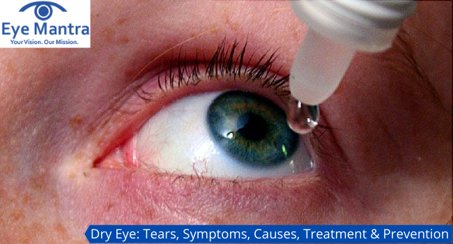 Dry Eye Tears, Symptoms, Causes, Treatment & Prevention