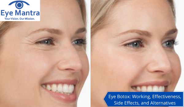 EYE BOTOX-EYEMANTRA