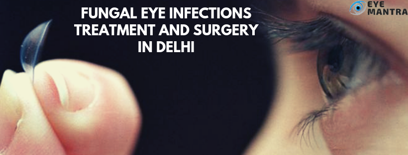 Fungal Eye Infection Types Symptoms Treatment And Surgery Eyemantra