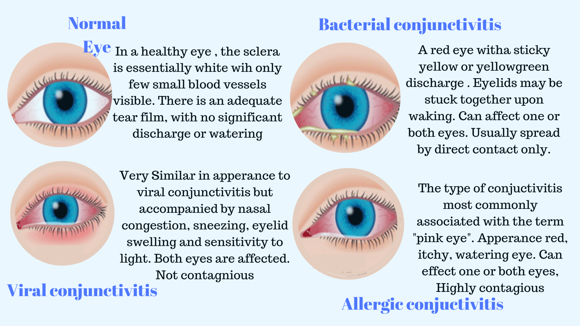 Fungal Eye Infection Types Symptoms Treatment Surgery Eyemantra Sexiezpicz Web Porn 0524