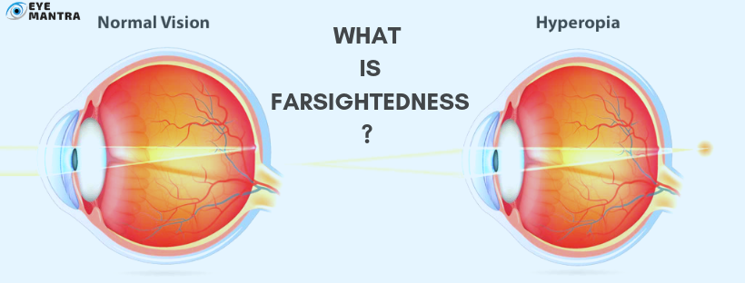 What Is Far Sighted