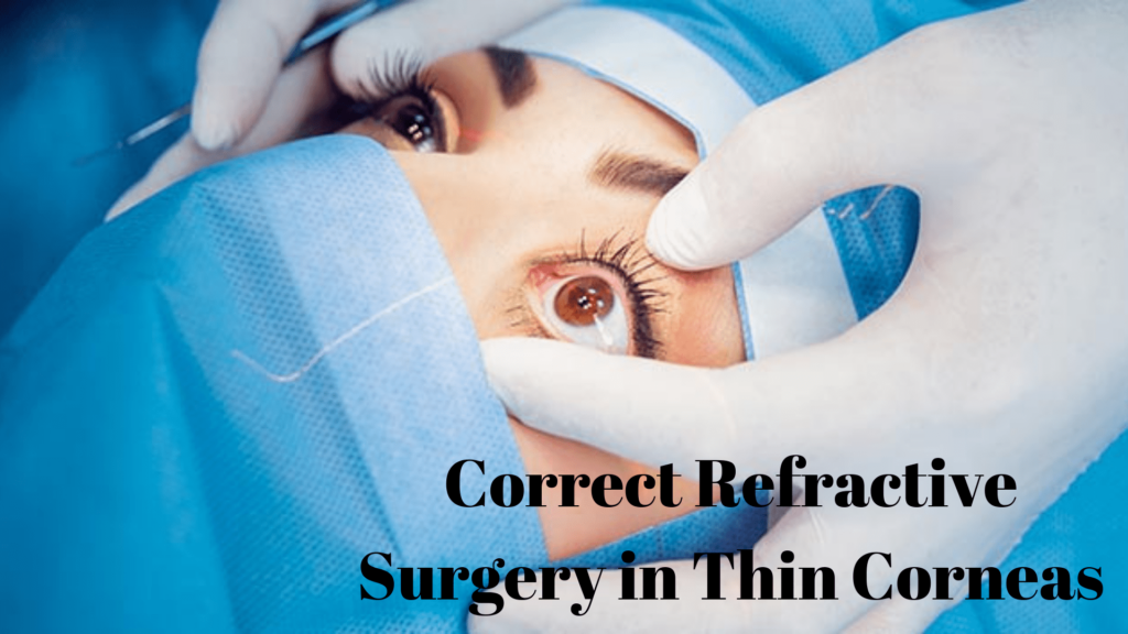 Correct Refractive Surgery