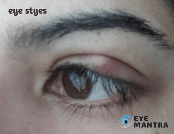 Eye Styles