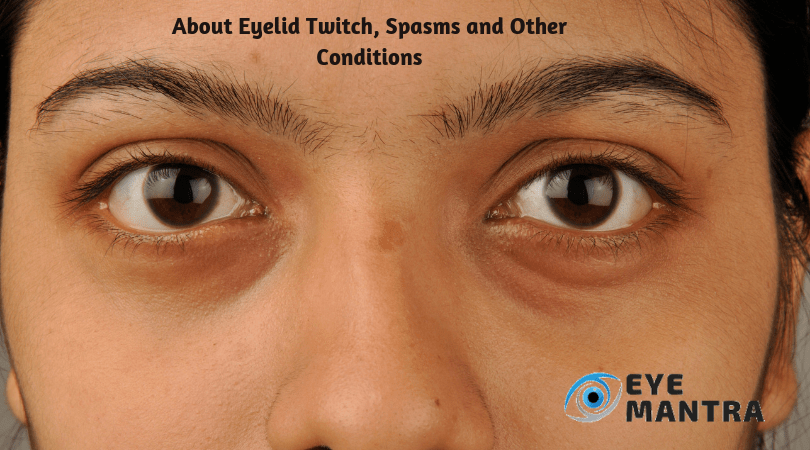 Eyelid Twitch