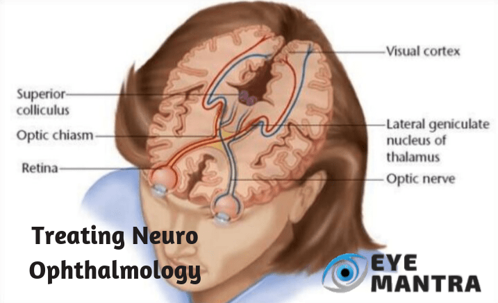 neuro-ophthalmology