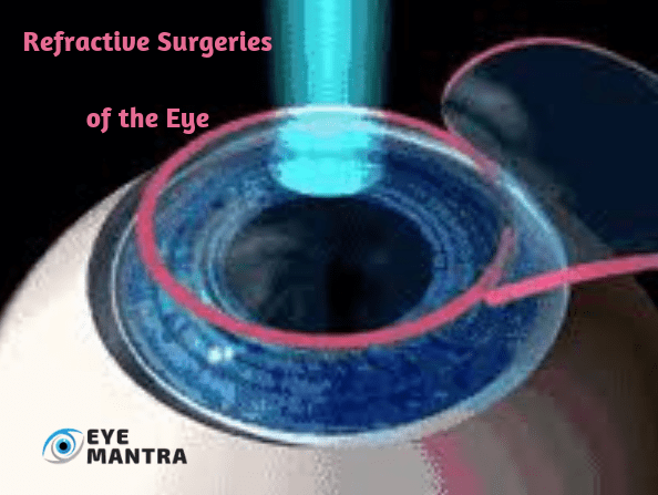 Refractive Surgery