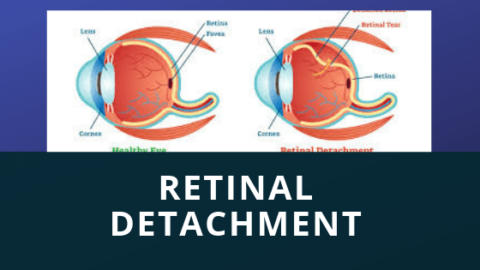 detached retina symptoms ear ringimg