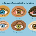 Take Care of Eyes | Vision Care | Simple Tips For Healthy Eyes