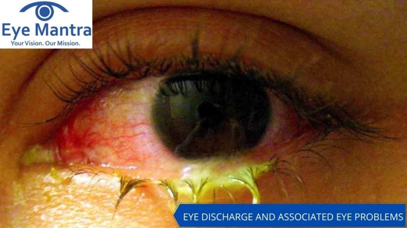 EYE DISCHARGE AND ASSOCIATED EYE PROBLEMS
