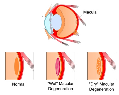 macula