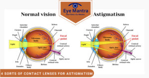 Contact Lenses for Astigmatism