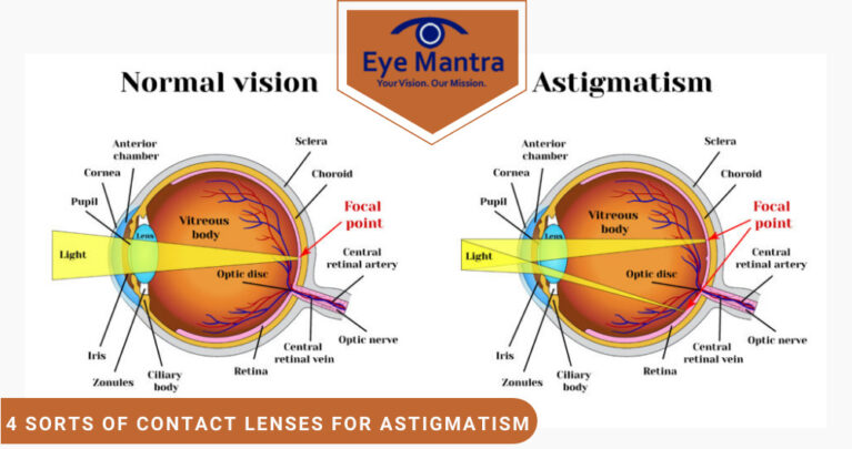 contact lenses for astigmatism