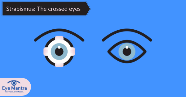 strabismus