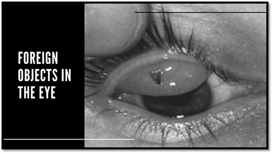eye injury in eyes