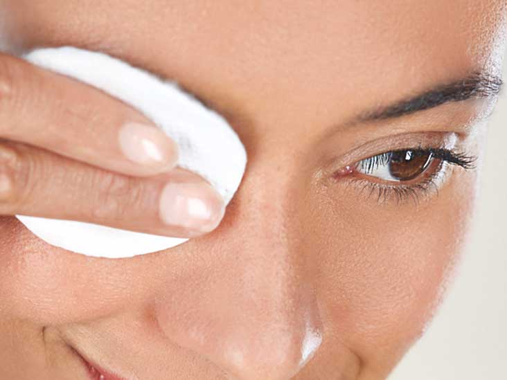 treatment of stye and chalazia with home remedies