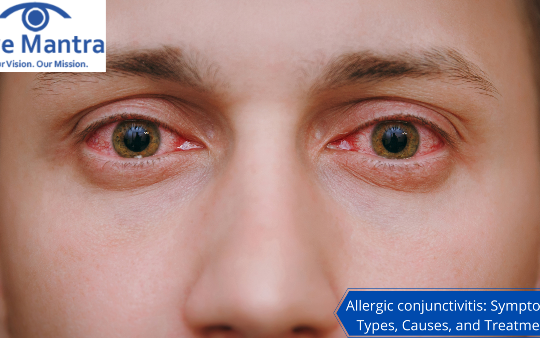 Allergic conjunctivitis Symptoms, Types, Causes And Treatment