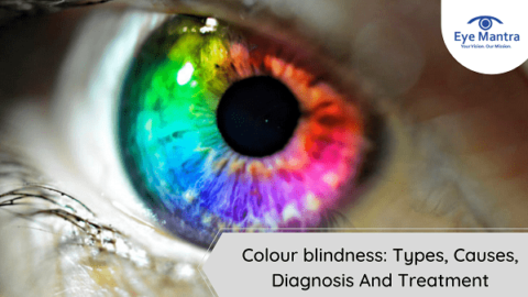 Colour blindness: Types, Causes, Diagnosis And Treatment