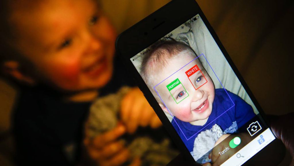 How can photos help detect an eye illness