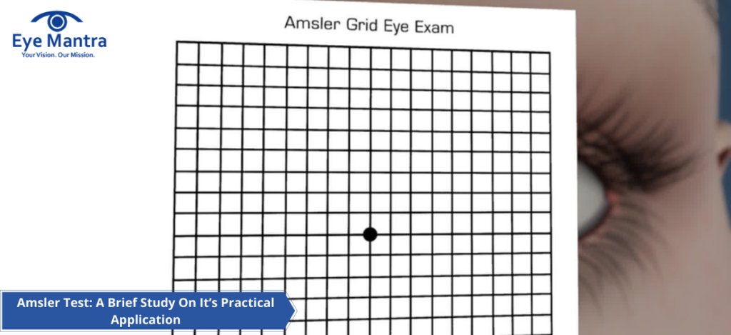 Amsler Test: A Brief Study On It's Practical Application