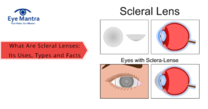 scleral lenses