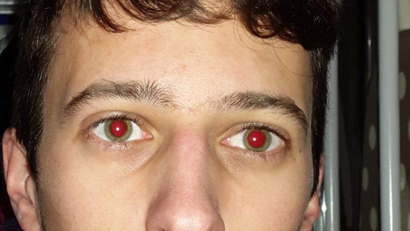 red eye effect