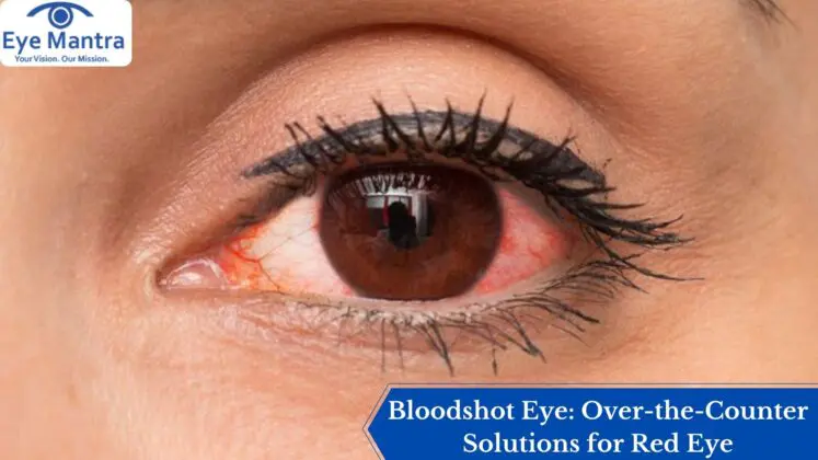 Bloodshot Eye