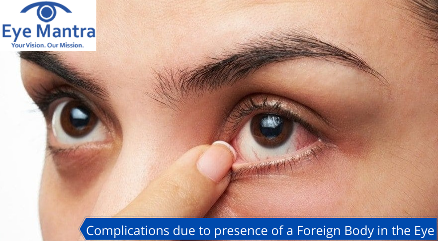 Foreign Body in the Eye