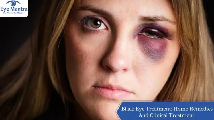 Black Eye