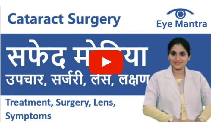 Cataract Surgery In Delhi - FREE Consultation with Best Doctors