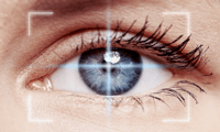 Lasik surgery