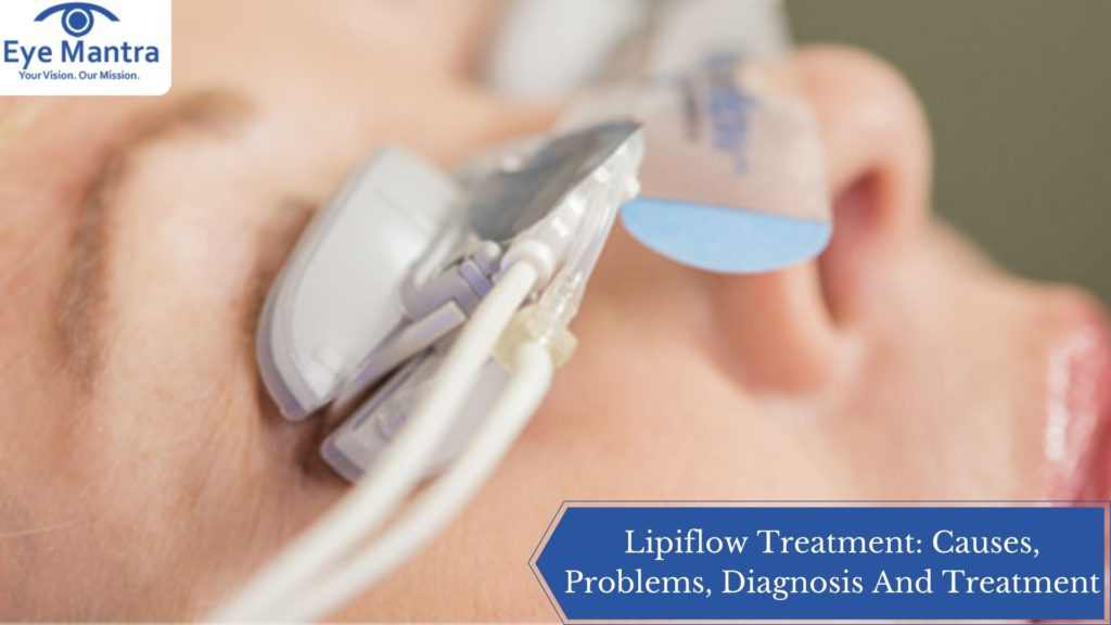 Lipiflow Treatment: Causes, Problems, Diagnosis And Treatment