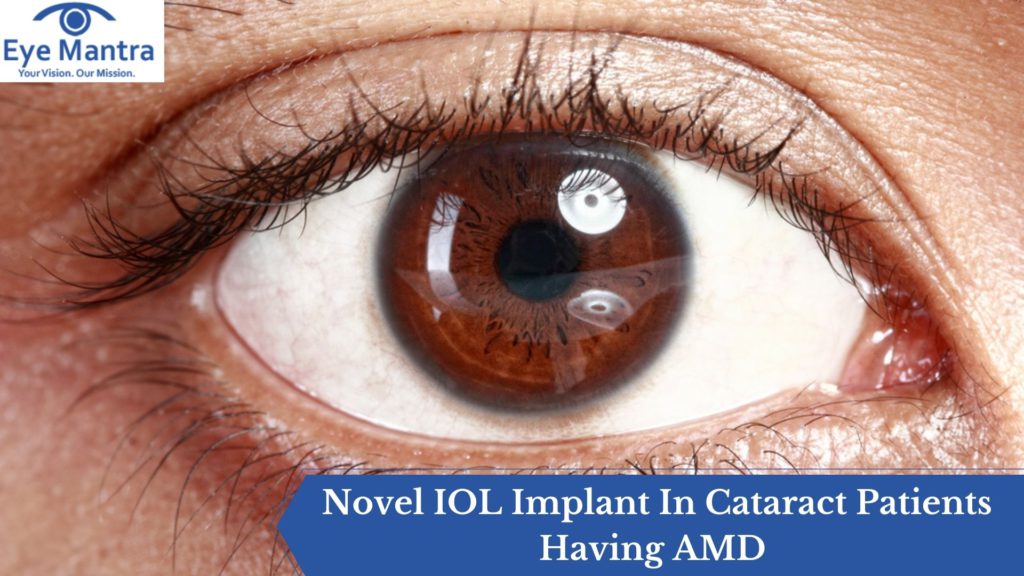 Novel IOL Implant In Cataract Patients Having AMD