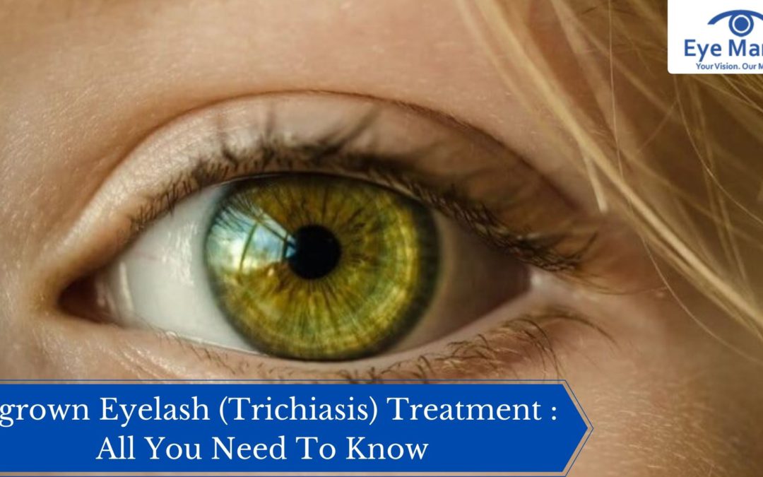 Ingrown Eyelashes (Trichiasis) Treatment : All You Need To Know