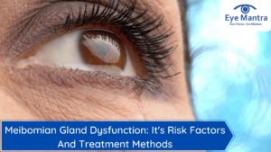 Meibomian Gland Dysfunction: It's Risk Factors And Treatment Methods