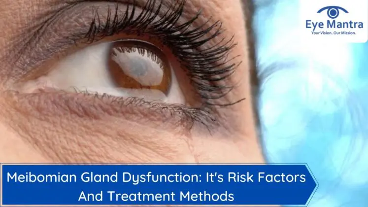 Meibomian Gland Dysfunction: It's Risk Factors And Treatment Methods