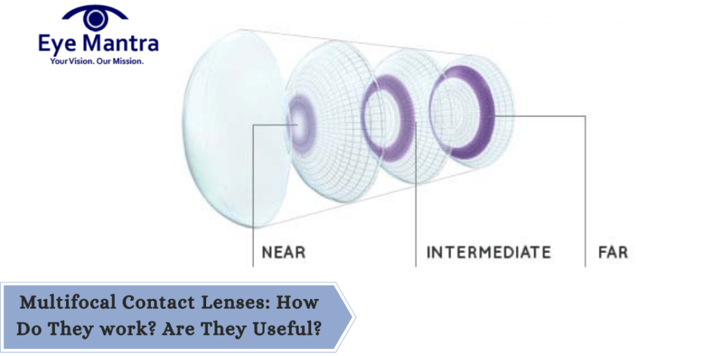 multifocal contact lenses