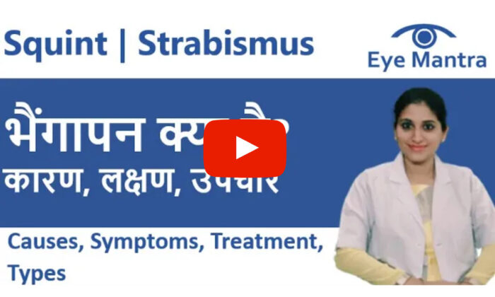 Best Squint Surgery In Delhi Strabismus Squint Doctors 