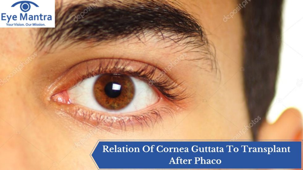 relation-of-cornea-guttata-to-transplant-after-phaco