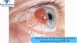 What are the Ocular Oncology practice guidelines during COVID-19 ?